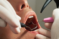 從牙齒還能看出愛滋病？　專家：牙醫看的不止是牙！「100種疾病」在口中出現症狀