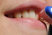 刷牙流血竟是牙周病症狀之一！5症狀自檢免得牙齒掉光