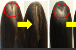 白髮、禿頭有救了！就靠「12種健髮食材」：由內而外鞏固毛囊、補充黑色素，免染髮、生髮水也能迅速恢復烏黑髮量！