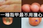 別讓「指甲」成為健康的「禍源甲」！「七種指甲異狀」直斷體內的危機病灶！｜每日健康 Health