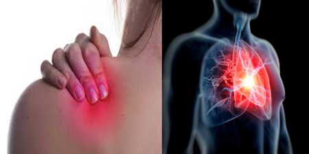 經常感到肩頸痠痛？小心，別讓「心臟」成為你的「心腹大患」！｜每日健康Health