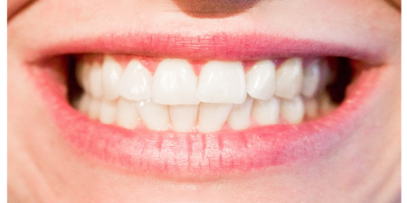 規律刷牙還是有可能「蛀牙」！「健齒五秘招」有效預防口腔疾病，到老都不用裝假牙｜每日健康Health