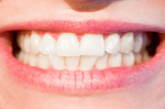 規律刷牙還是有可能「蛀牙」！「健齒五秘招」有效預防口腔疾病，到老都不用裝假牙｜每日健康Health