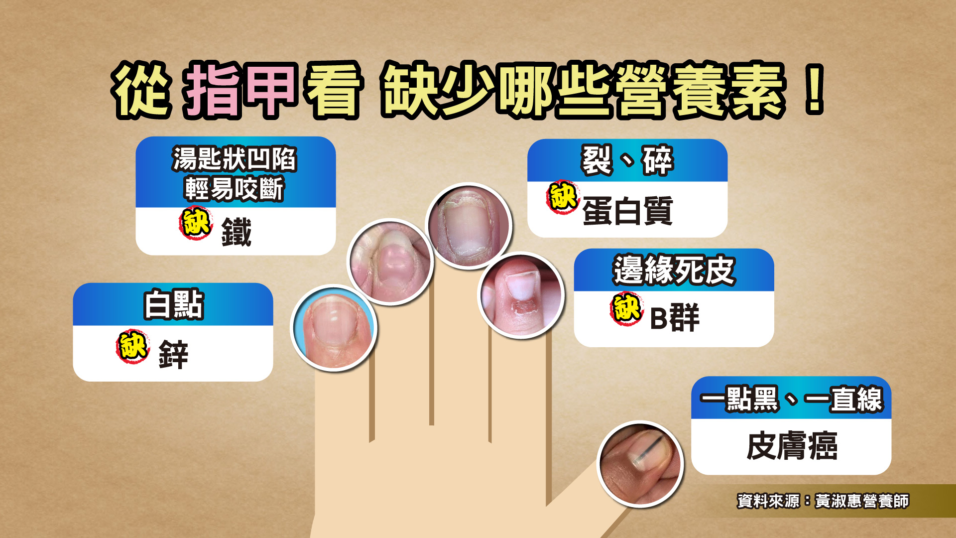 TVBS《健康2.0》
