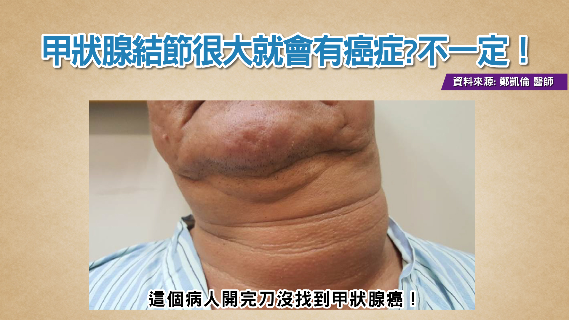 圖/TVBS提供