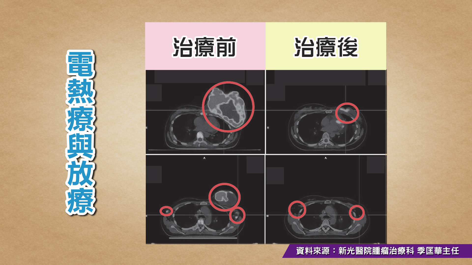 圖/TVBS提供