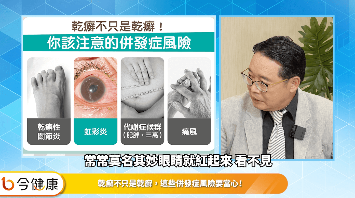振興醫院一般內科主任、臨床試驗中心主任、過敏免疫風濕科主治醫師林孝義醫師