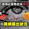 吃炸雞滑手機小心視網膜病變 從眼睛看健康 膽固醇過高有徵兆