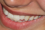 維持口腔健康，除了刷牙、用牙線之外，還有「8大招」，只要一分鐘就能擁有自信笑容！