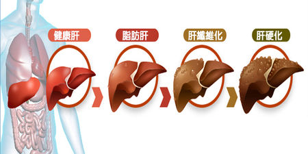皮膚差、手腳浮腫是肝臟病變？越填越傷心的「肝傷評分表」，超過8分速就醫｜每日健康Health