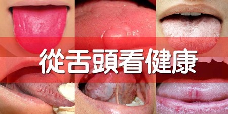 從「舌頭」秒讀健康狀態！這幾種外觀千萬別忽略，恐為「舌癌」、「口腔癌」徵兆｜每日健康
