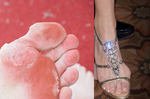 鞋子太緊形同「現代裹小腳」！腳窒息「九大傷害」雞眼、香港腳終身難癒｜每日健康Health