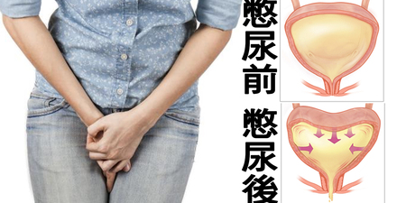 「憋尿」憋過這時間竟能「救膀胱」！但憋太久慎防「三種泌尿症狀」｜每日健康 Health