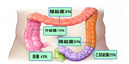 台「大腸癌」每半小時多一人！培養「三習慣」息肉、癌症就不來｜每日健康 Health