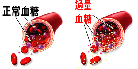 控制「血糖」就是控制「衰老」！調整「用餐順序」，戰勝餐餐「高糖」！｜每日健康Health