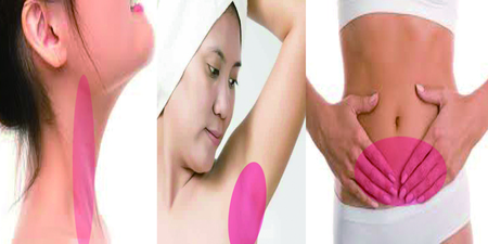 【男女必看】淋巴結腫大＝淋巴瘤？簡單「三部位」分辨良惡性！｜每日健康Health