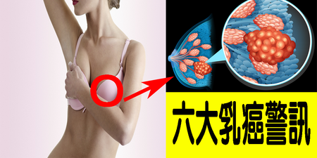 「乳癌」存活率高達97%，為什麼仍奪走無數女性生命？｜每日健康Health