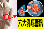 「乳癌」存活率高達97%，為什麼仍奪走無數女性生命？｜每日健康Health