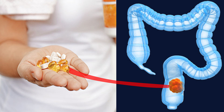 研究：服用「抗生素」易得「大腸癌」？ 這四種人最危險｜每日健康Health