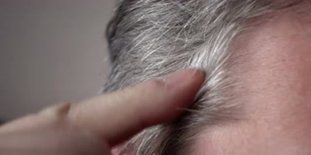 「白頭髮」不是病？埃及研究：男性少年白恐增「心臟病」風險｜每日健康Health