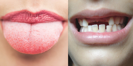 刷牙「舌頭」不清潔，「菌斑」把牙齦吃乾淨！「六大麻煩」牙周萎縮、牙齒脫落都上門！｜每日健康Health