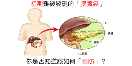 體重突然減輕？食慾不振？小心「胰臟癌」找上門｜每日健康 Health