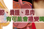 「結節、囊腫、息肉」有可能會癌變嗎？專家：三種外觀要當心｜每日健康Health