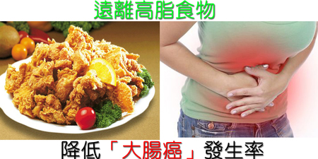 台灣「大腸癌」發生率是全球之冠！醫師警告：【高油】飲食絕對碰不得｜每日健康Health