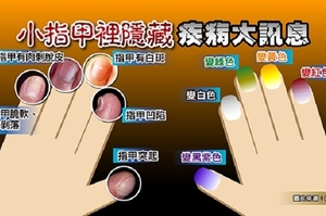 藏在「指甲、灰指甲」裡的「十種健康訊號」！這種指甲離「心肺衰竭」一步之遙！｜每日健康Health