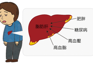 不喝酒、體重也正常，為何我也有「脂肪肝」？照著【三少一多】有效擊退脂肪肝｜每日健康Health