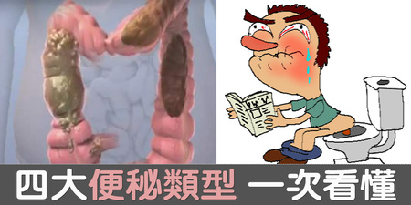 青菜吃得多，卻總是「上不出來」？【四大便秘類型】一次解密，一出現這種便秘情況速就醫｜每日健康Health