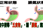 「暴飲暴食」腹脹難消？速吃「五食物」讓腹部不再「脹氣」、「難瘦」｜每日健康 Health