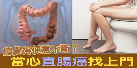 上大號老是「有完沒完」？當心「大腸癌」作祟！關於便意不斷的「三大真相」一次看懂｜每日健康Health