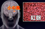 四十歲以上「小中風」九人就一人！激活「抗三高分子」的神奇食物「紅麴」這樣入菜！ │ 每日健康 Health