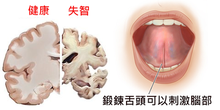 活化腦細胞、神經，每天這樣動「舌頭」→ 記憶力回春三十年，「失智症」永不上門