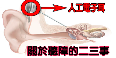 有「電子耳」輔助為何仍無法正常「接電話」？爸爸媽媽要知道的「聽障」二三事｜每日健康Health