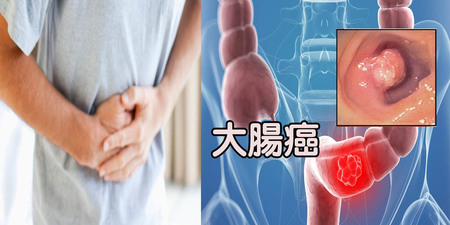 別只看「顏色」！整日便意停不了，當心「大腸癌」上門！一天排便超過這次數最危險｜每日健康Health