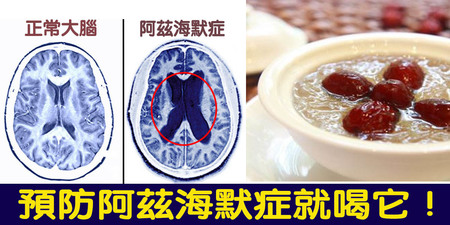 年過50記性越來越差？一碗「大腦青春湯」快速修復腦損傷、「老年痴呆」不上門｜每日健康Health