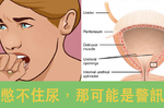 太常跑廁所也不健康！這9種病況也許正在發出求救訊號！