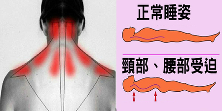 叫醒你的不是鬧鐘是「落枕」？電腦族等「三大族群」更需注意「鬼掐脖」！｜每日健康Health