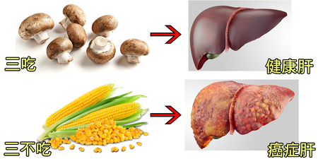 肝癌「化療」也沒用！養成「三吃三不吃」防癌好習慣才能修復肝臟、根除癌症因素！｜每日健康 Health