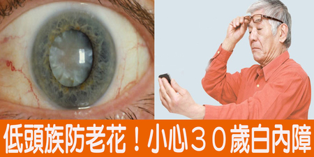 緊盯螢幕３０歲就老花眼、白內障？【低頭族】預防眼睛老化二大要點！｜每日健康Health