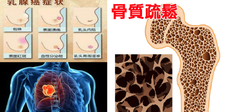 罹患機率100%！三高、癌症、骨質疏鬆都有「遺傳性」，各別「預防絕招」一次公開｜每日健康Health