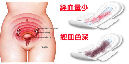 經血量少、下背痛都怪「子宮太寒」！中醫「暖宮三法」打通氣血、髒血自己排｜每日健康Health