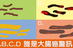 你的糞便透露「腸癌」跡象嗎？一秒判讀「大便四類型」，兩種外觀最危險｜每日健康Health