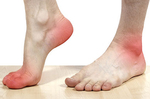 「足底筋膜炎」靠這「三招」平定！腳下從此「太平盛世」一輩子｜每日健康 Health