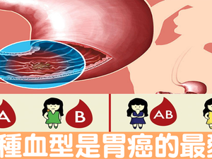 什麼！「血型」竟然決定「胃癌」機率？這種血型再加上「口臭」風險爆表｜每日健康