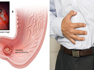 太危險！胃部這裡痛竟是「胃癌」徵兆？輕忽「胃癌五徵兆」五年存活率剩5%｜每日健康Health
