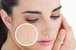 您的皮膚容易乾癢嗎？ 「乾性肌」必看！照護「乾性肌膚」的六大守則。