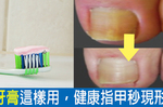 只拿牙膏來刷牙就遜掉了！牙膏搭一物這樣抹，滅瘀、去味、健甲一舉多得！